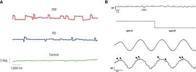Clinical utility of square-wave jerks in neurology and psychiatry